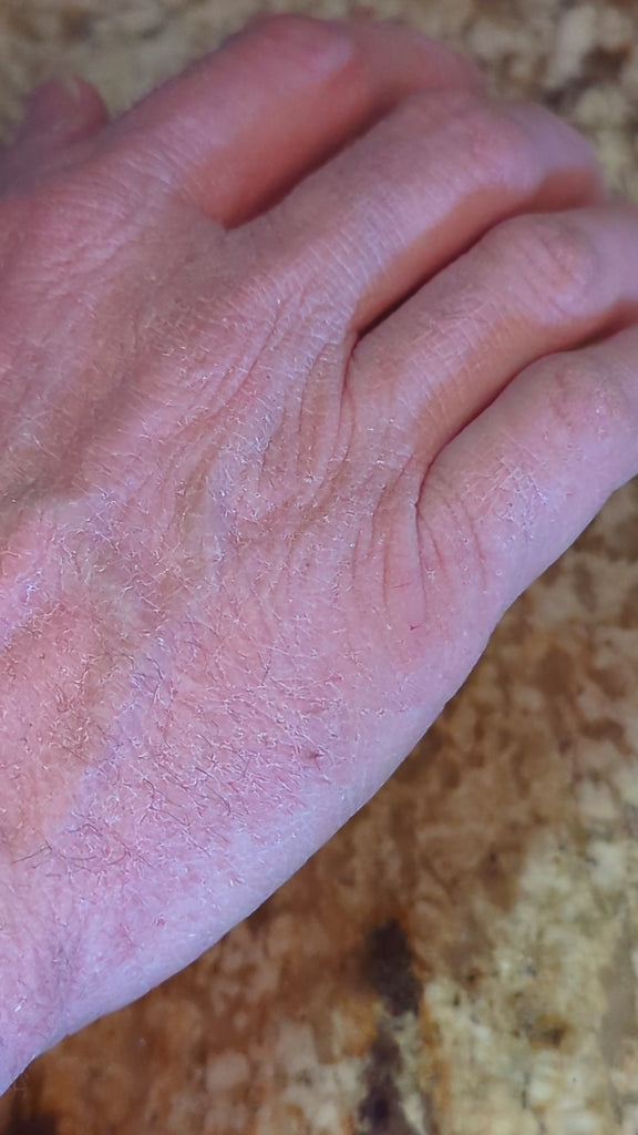 applying sandalwood shea butter hand and body lotion to a dry, cracked hand