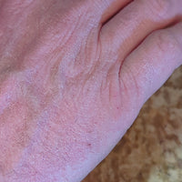 applying sandalwood shea butter hand and body lotion to a dry, cracked hand